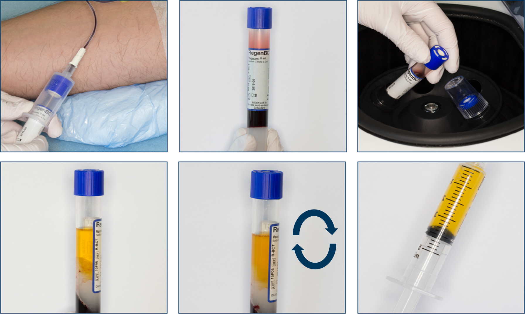 haarausfallmngmt-steps