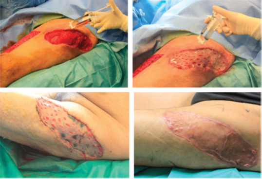 wundversorgung-studie2-1