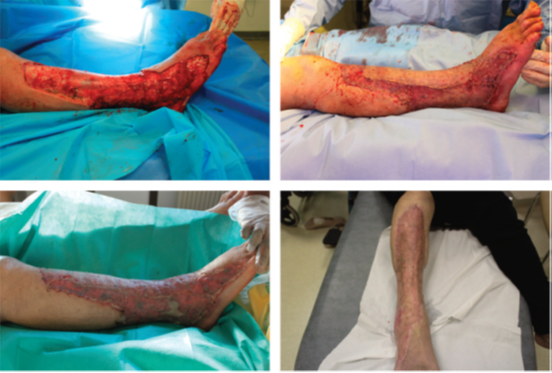 wundversorgung-studie2-2