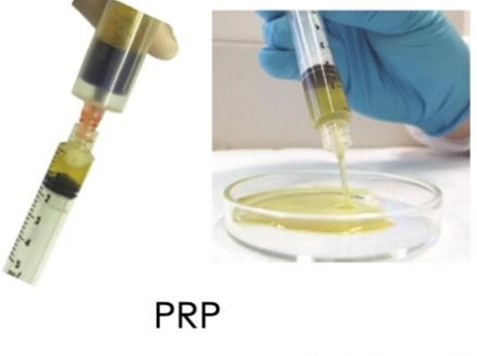 regenats_darstellung1